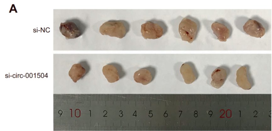 4篇SCI共用一把鋼尺遭撤稿！涉及多所985，包括多位院長(zhǎng)、重點(diǎn)專(zhuān)科負(fù)責(zé)人…